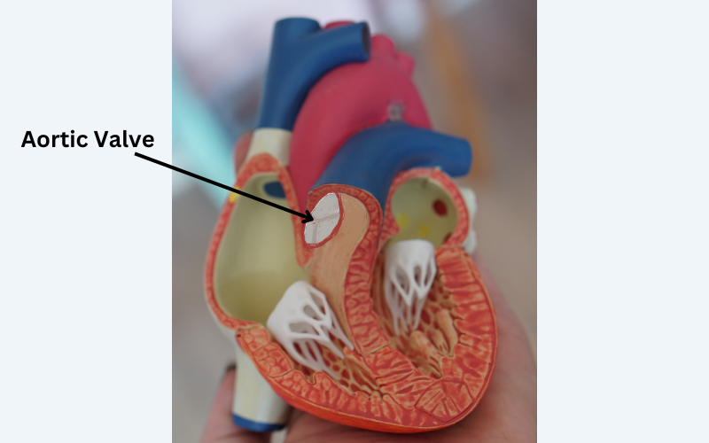 Aortic Valve Replacement